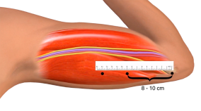 Persona usando una laptop para gestionar su salud